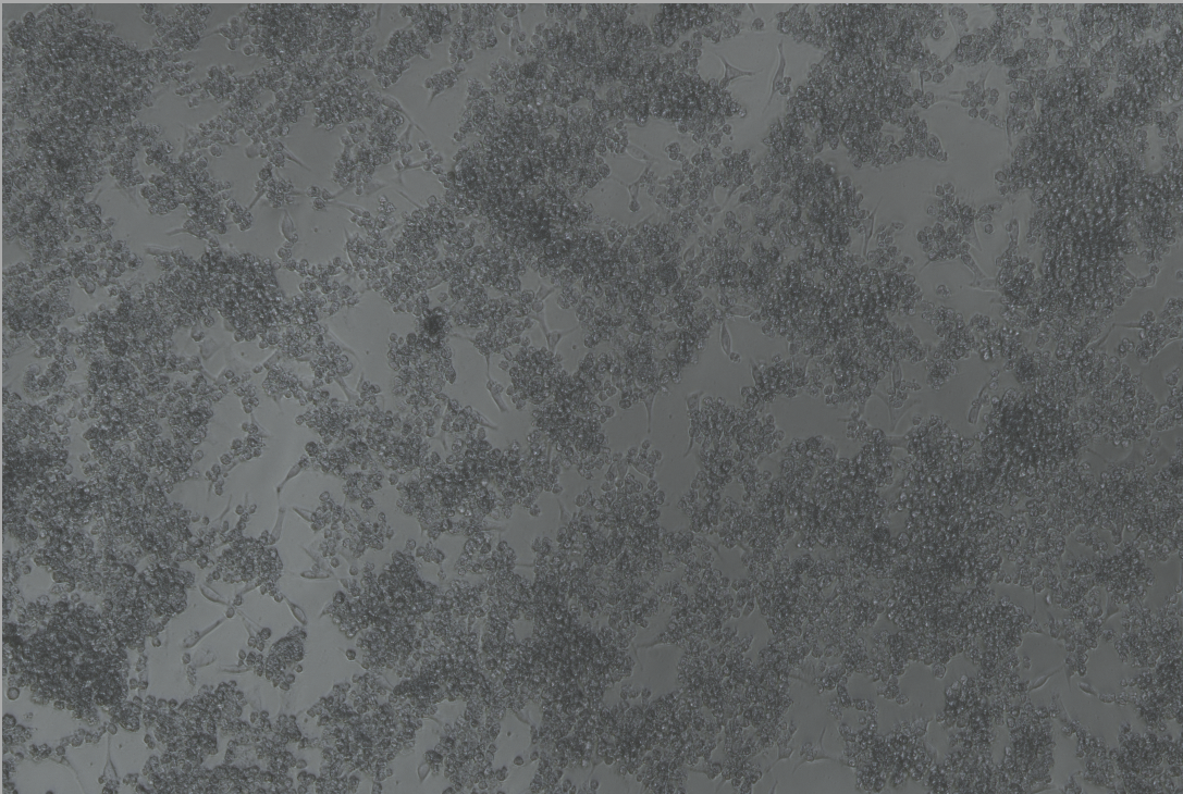 Human rhinovirus 41-BNCC