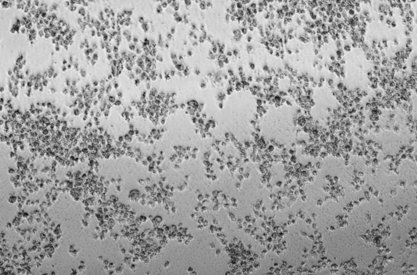 Human rhinovirus 43-BNCC