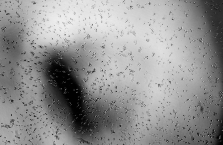 Human echovirus 25-BNCC