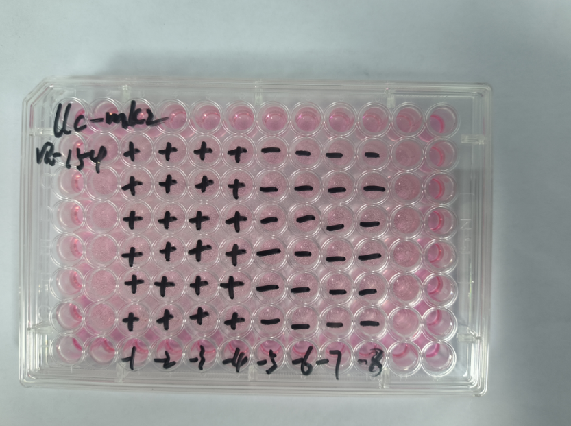 Human echovirus 27-BNCC