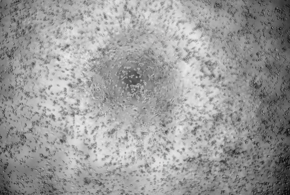 Human echovirus 27-BNCC