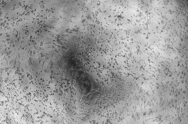 Human echovirus 26-BNCC