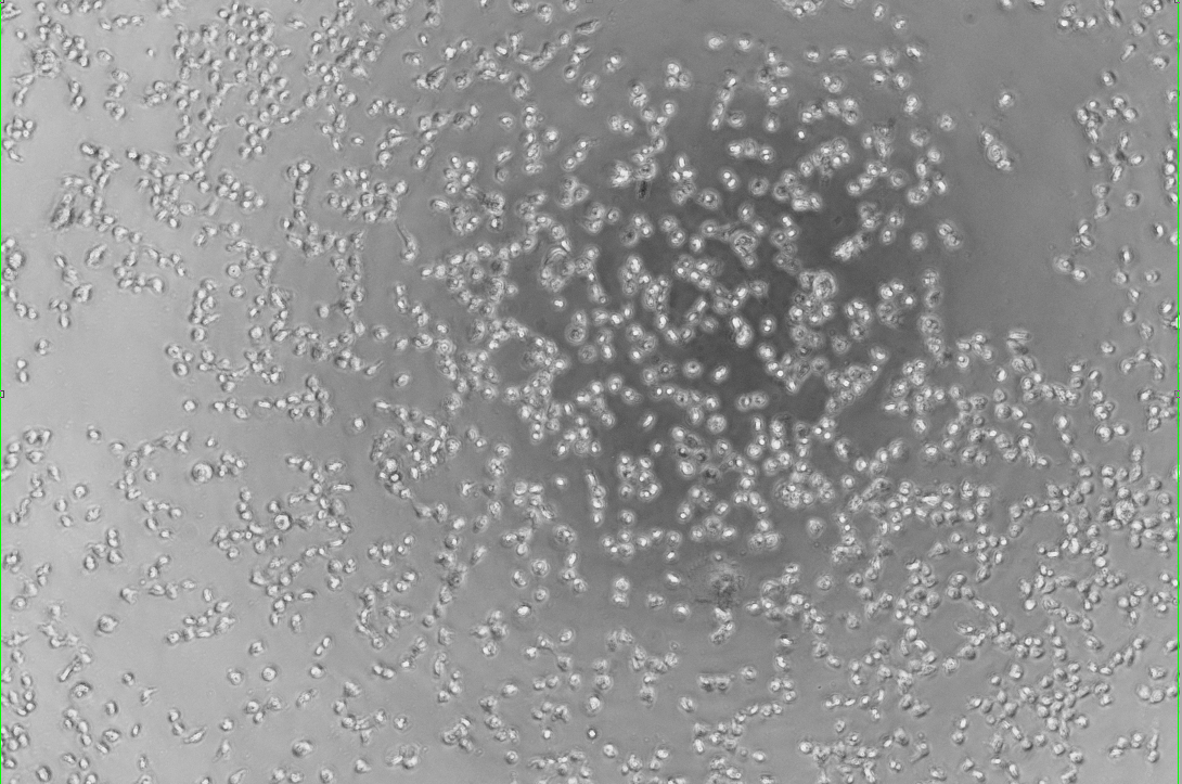 Human echovirus 31-BNCC