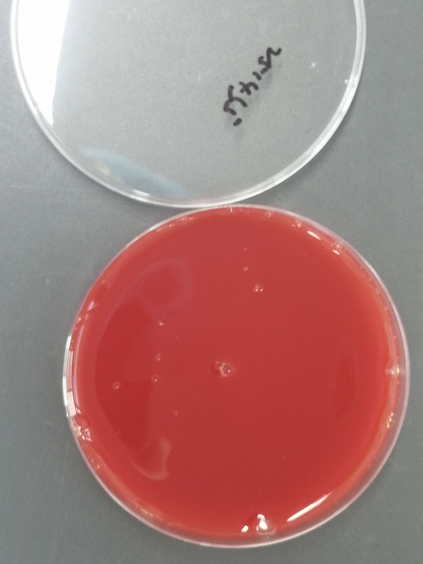 Bolte's Enteroclostrum Nucleic Acid Reference Material (Thermally Inactivated) (Strongly Positive)-BNCC