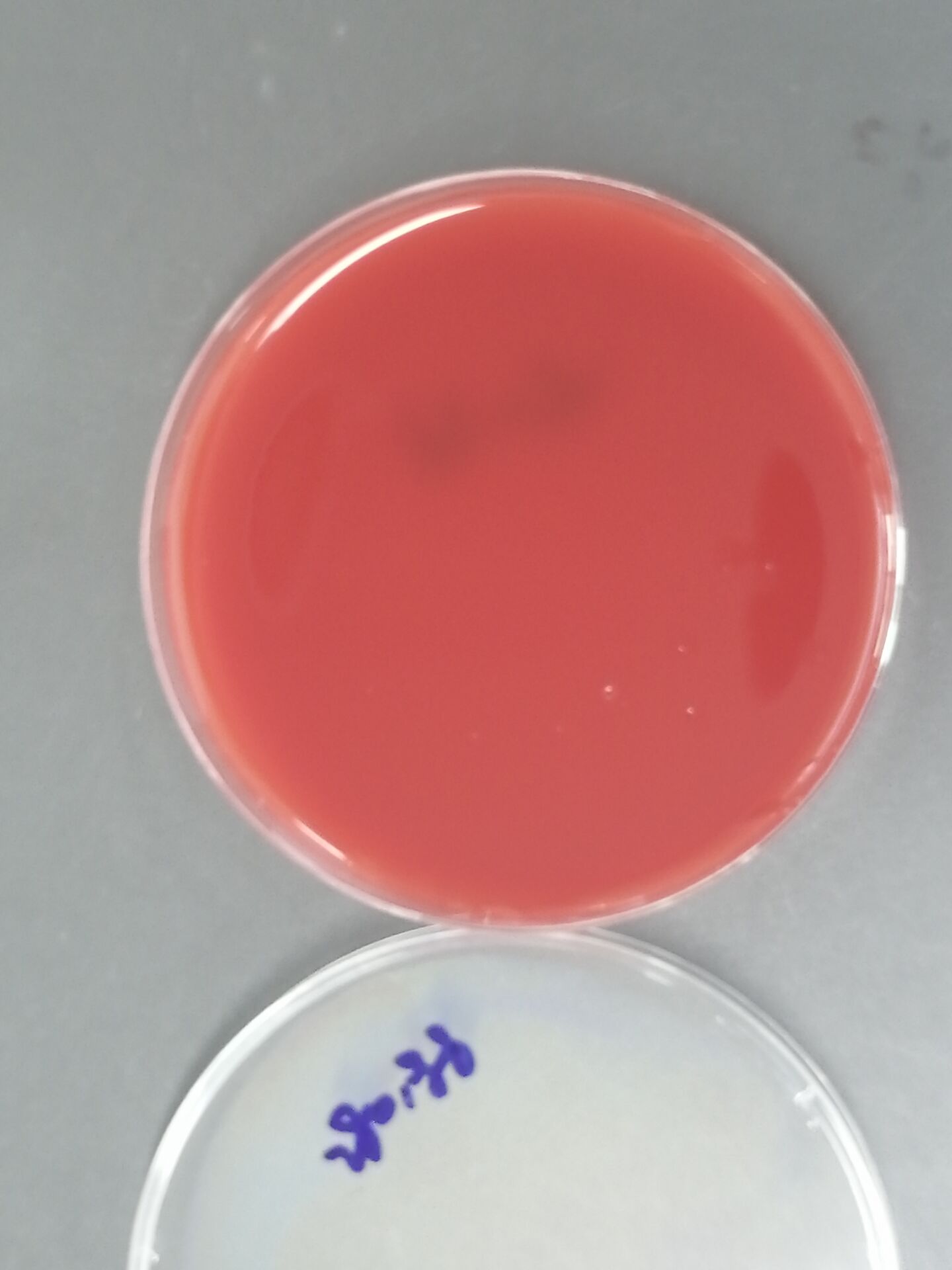 Fusobacterium nucleatum subsp. nucleatum Nucleic Acid Reference Material (Thermally Inactivated) (Strongly Positive)-BNCC