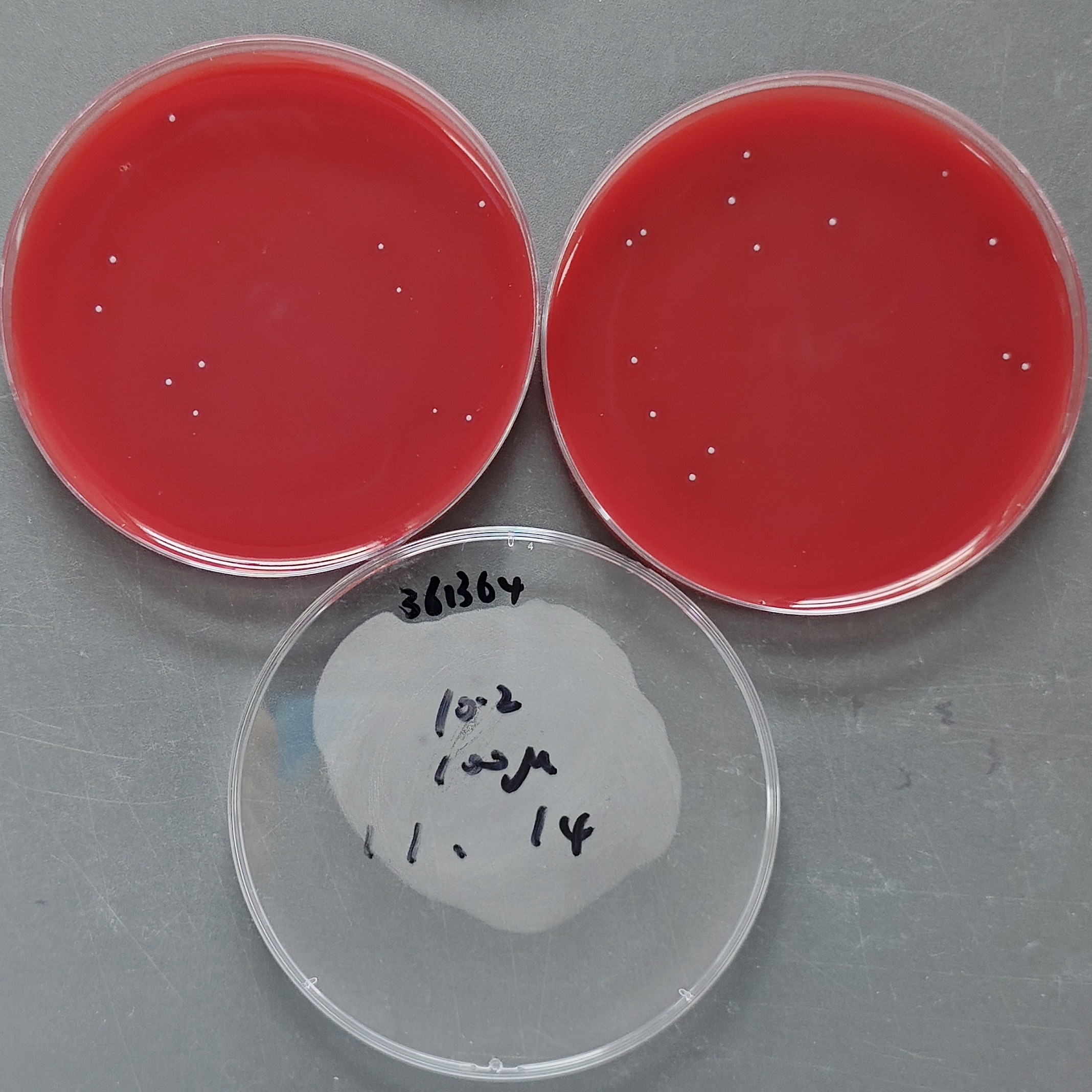 Quantitative strain of Streptococcus pyogenes-BNCC