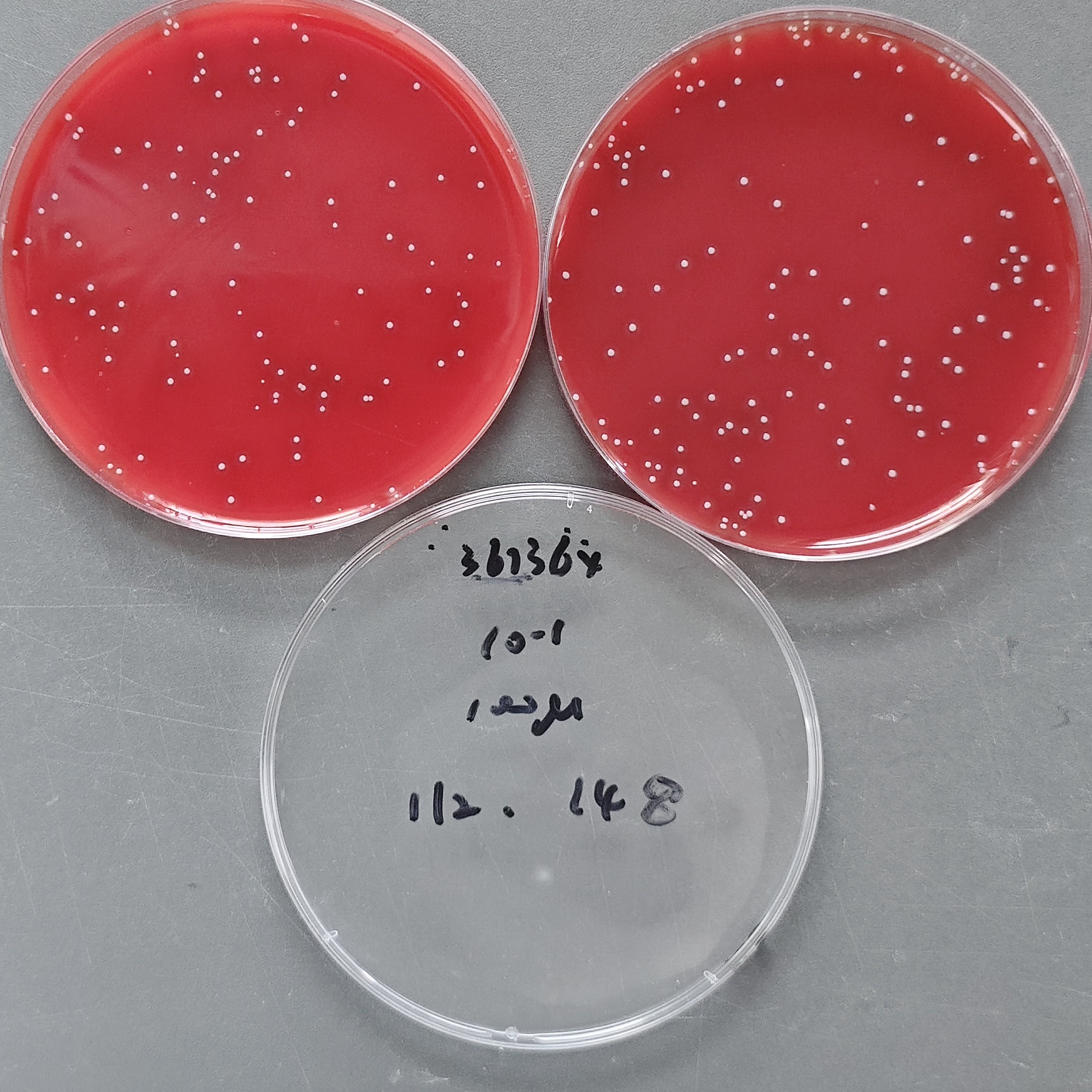Quantitative strain of Streptococcus pyogenes-BNCC
