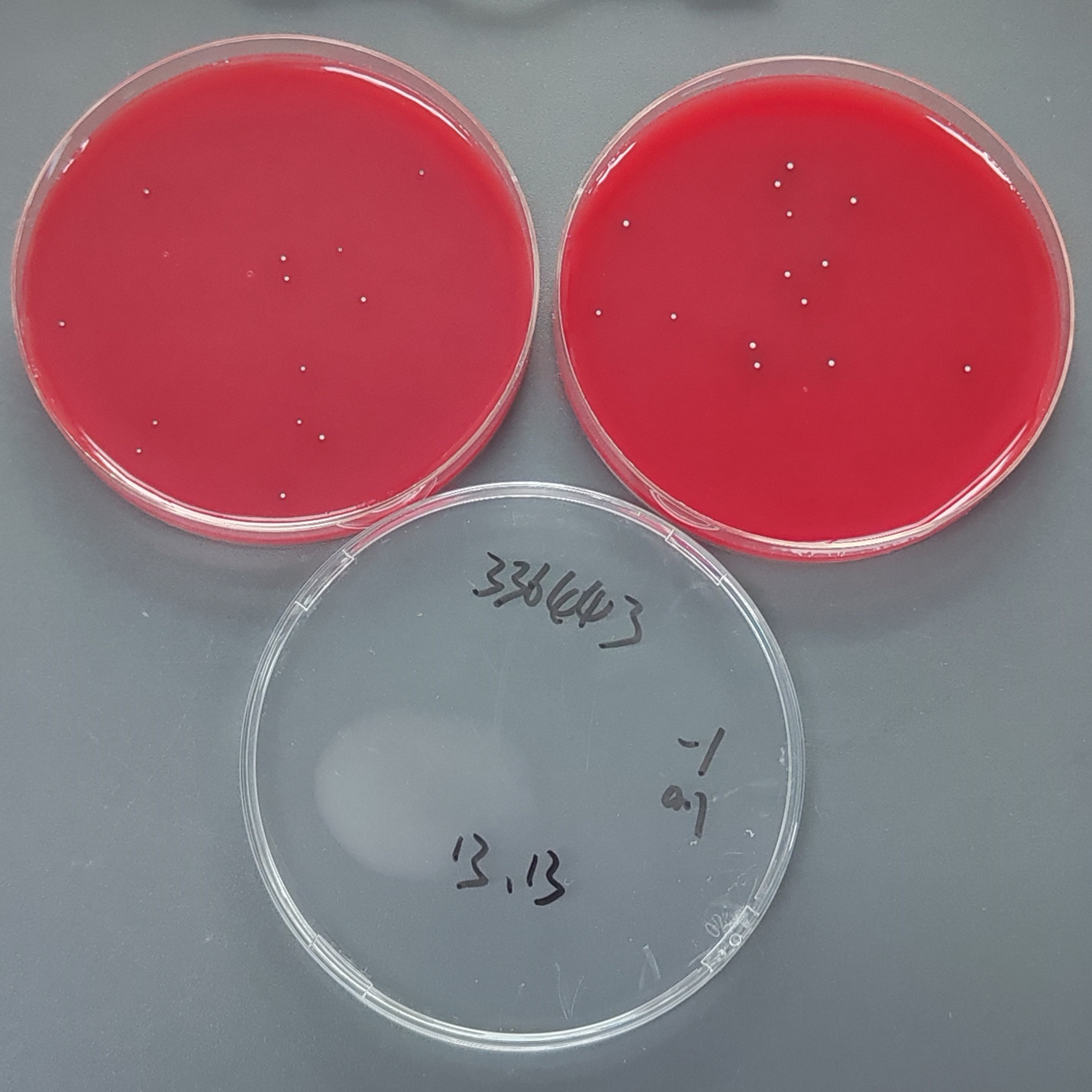 Quantitative strain of filamentous bacteria in blister epidermis-BNCC