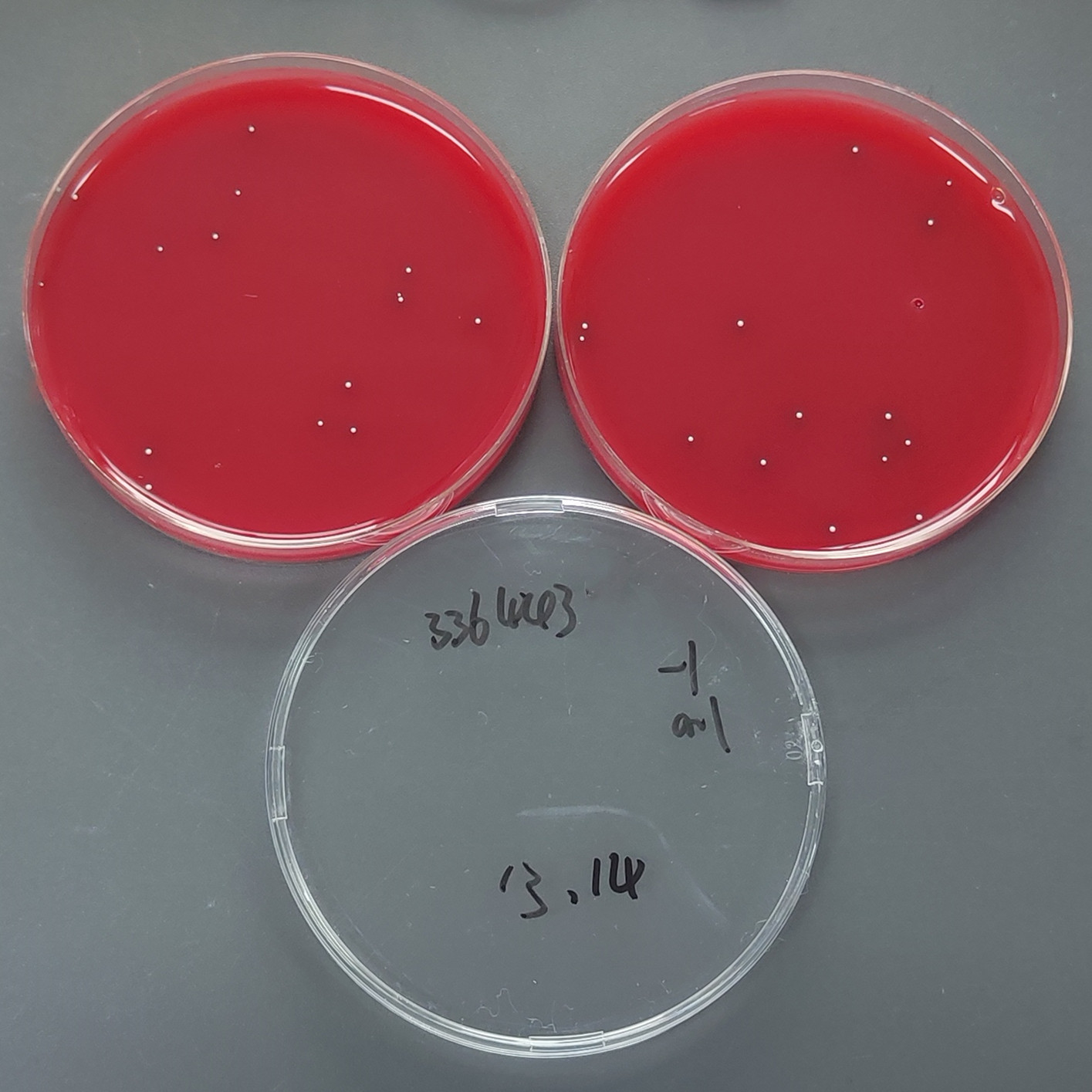 Quantitative strain of filamentous bacteria in blister epidermis-BNCC