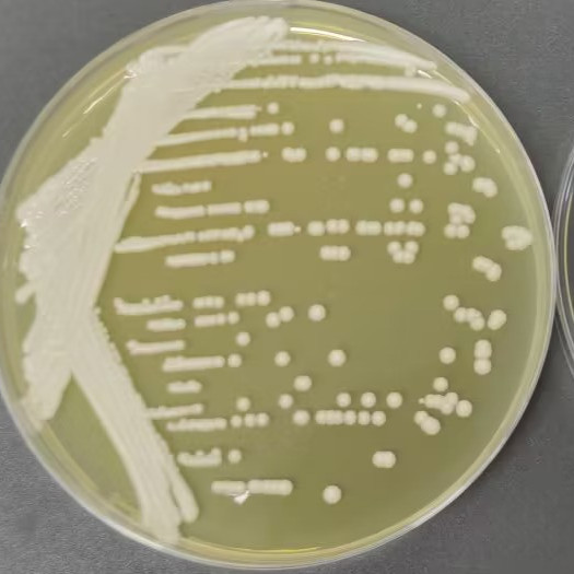 Saccharomyces cerevisiae-BNCC
