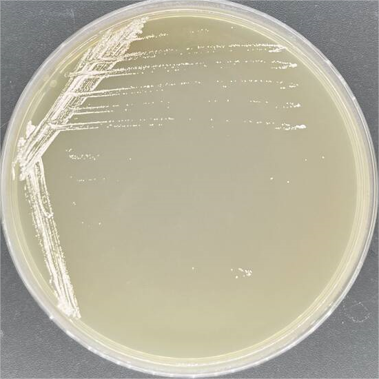 Short chain Nocardia-BNCC