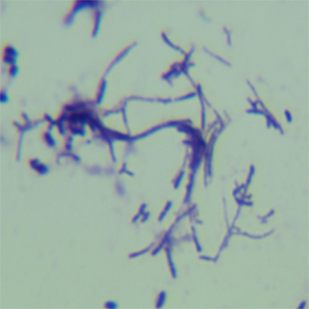 Short chain Nocardia-BNCC