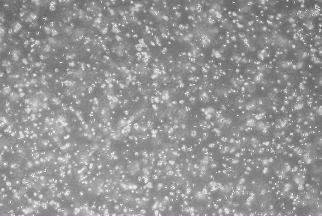 JC Polyomavirus Deoxyribonucleic Acid Liquid Indoor Quality Control-BNCC