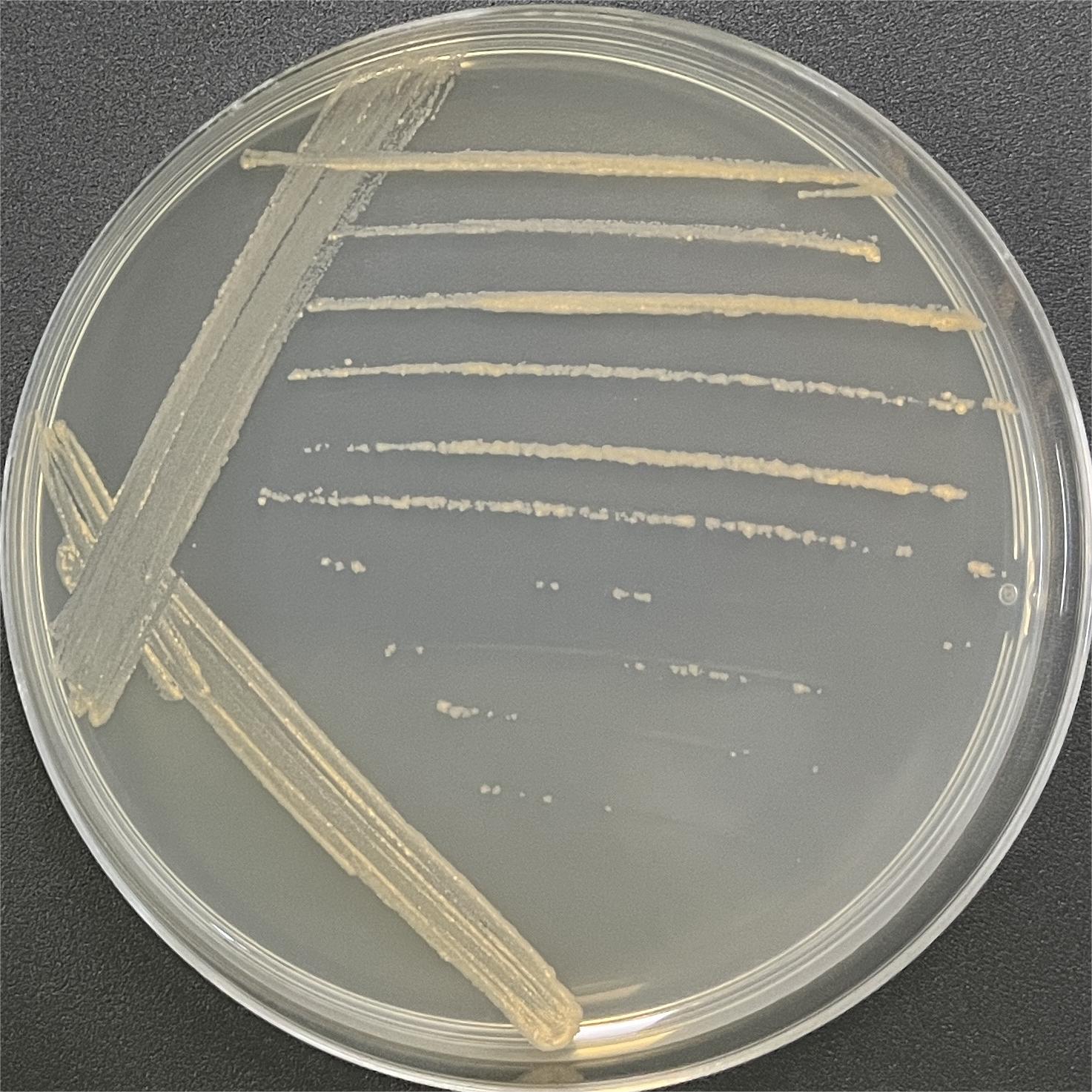 Montessori Medical Center Mycobacterium-BNCC