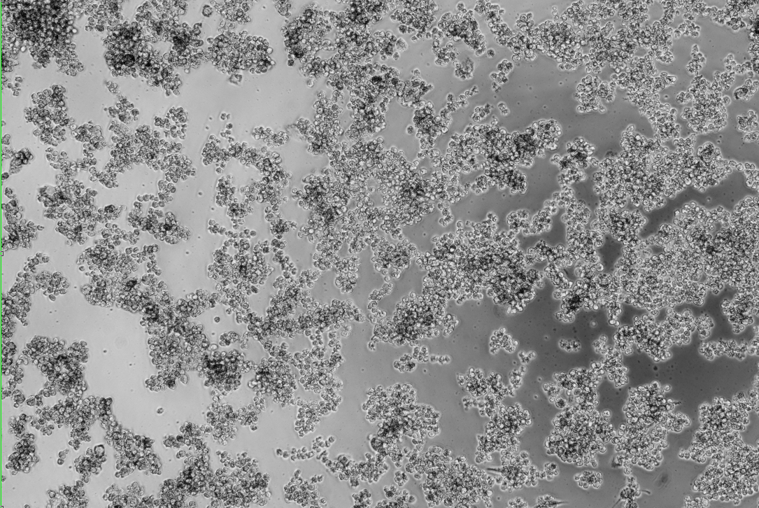 Human rhinovirus 95-BNCC