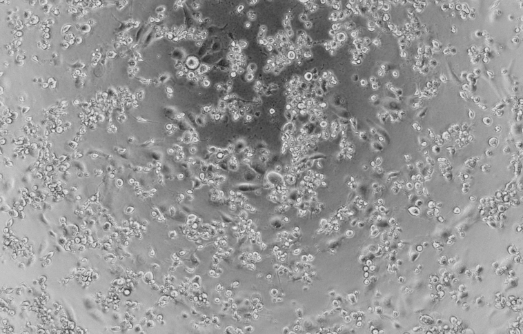 Human echovirus 15-BNCC