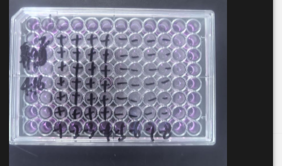 Rhinovirus 92-BNCC