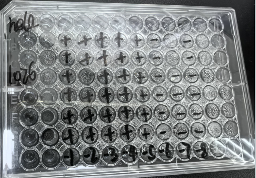 Coxsackievirus A20-BNCC