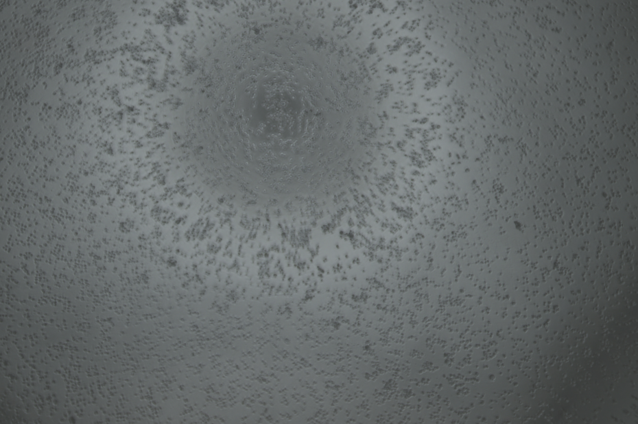 Human rhinovirus 74-BNCC