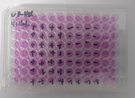 Human rhinovirus 76-BNCC