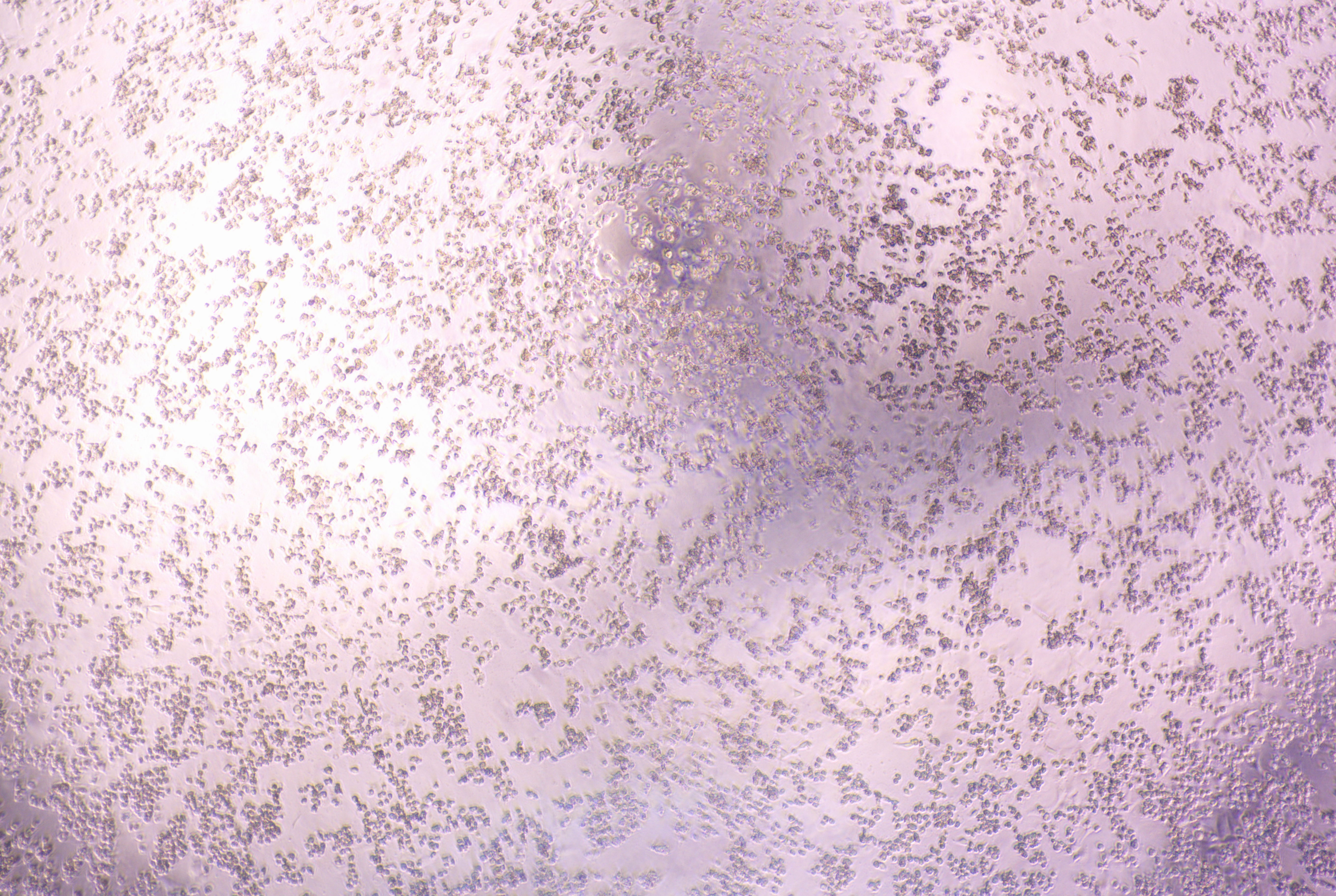Human rhinovirus 76-BNCC