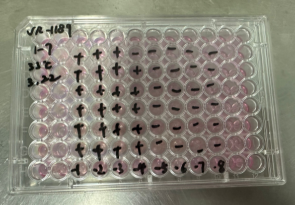 Human rhinovirus 79-BNCC