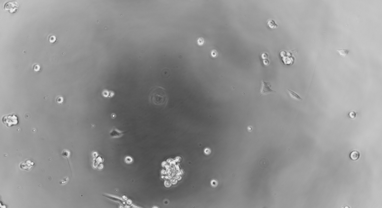 Human Herpesvirus 1-BNCC