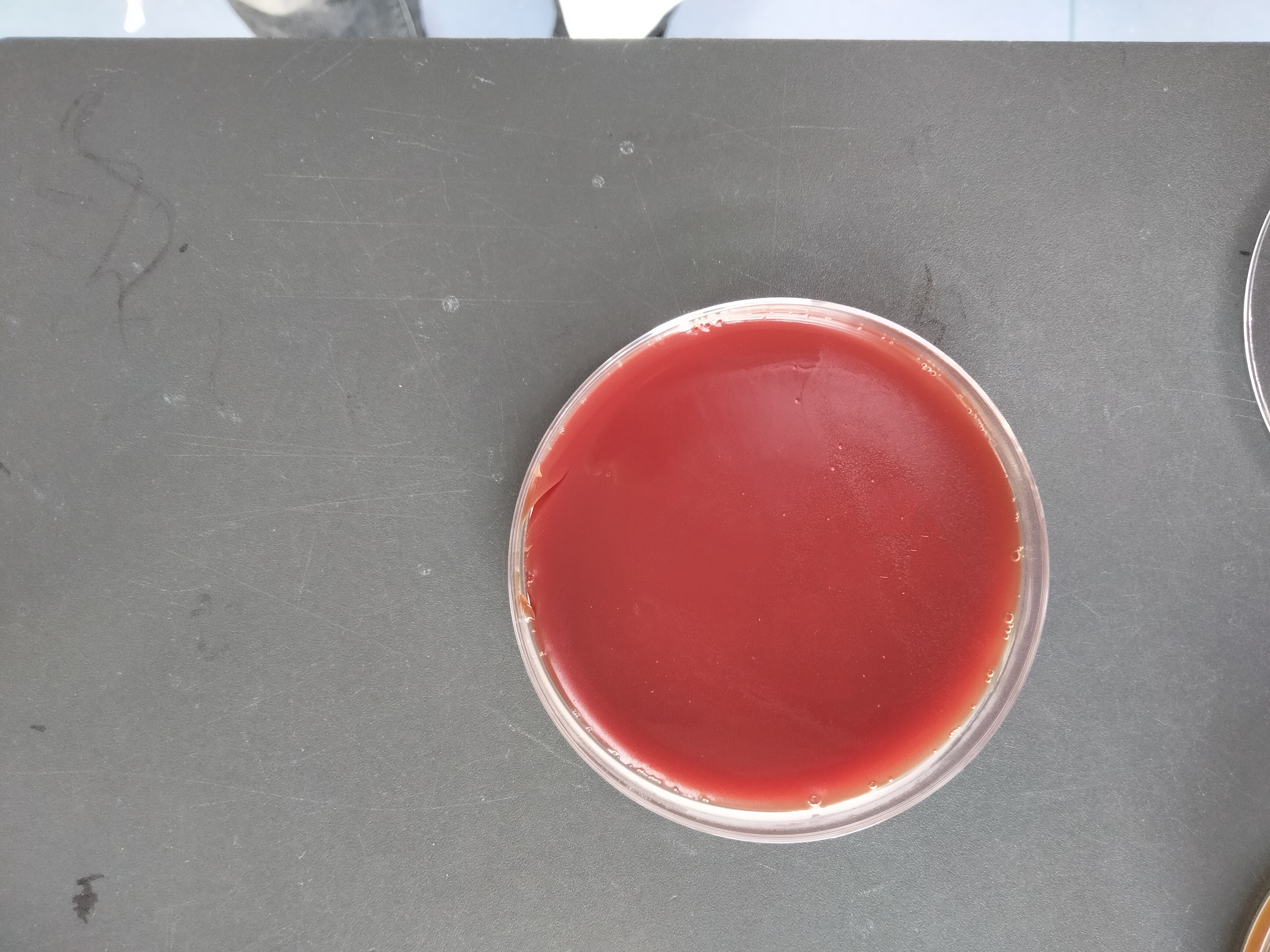 Helicobacter pylori reference substance (Chemical inactivation) (strongly positive)-BNCC