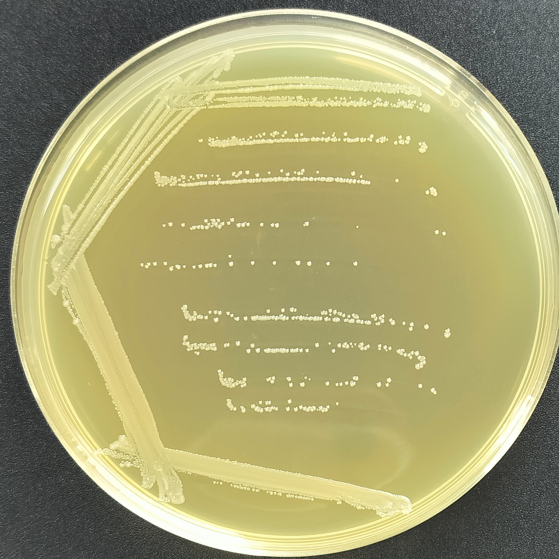 Rodent bacteria invading the lungs-BNCC
