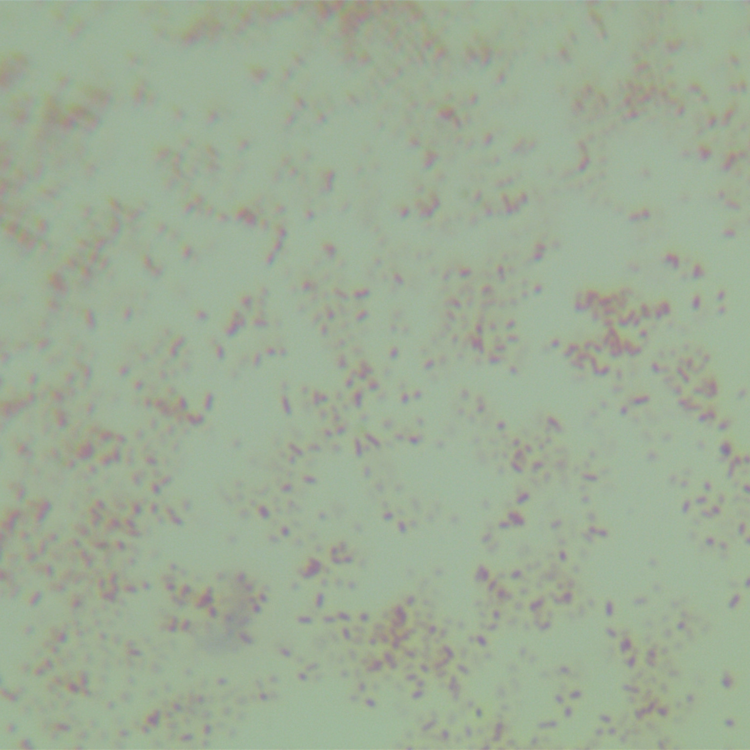 Rodent bacteria invading the lungs-BNCC