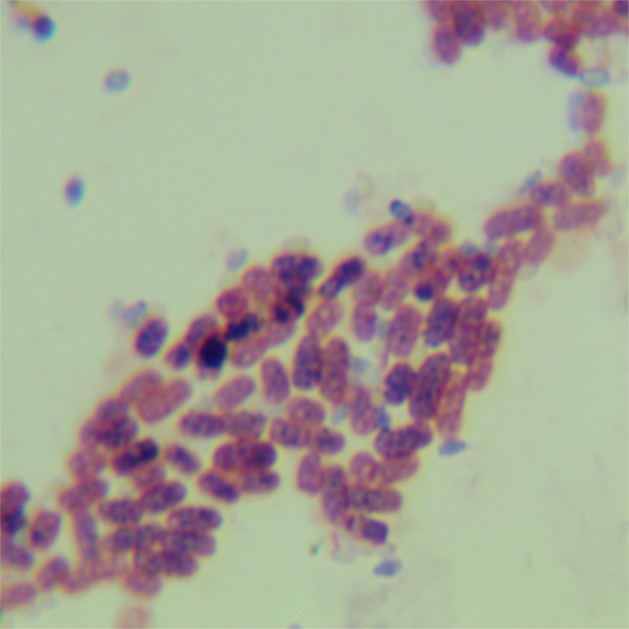 Bacillus subtilis-BNCC