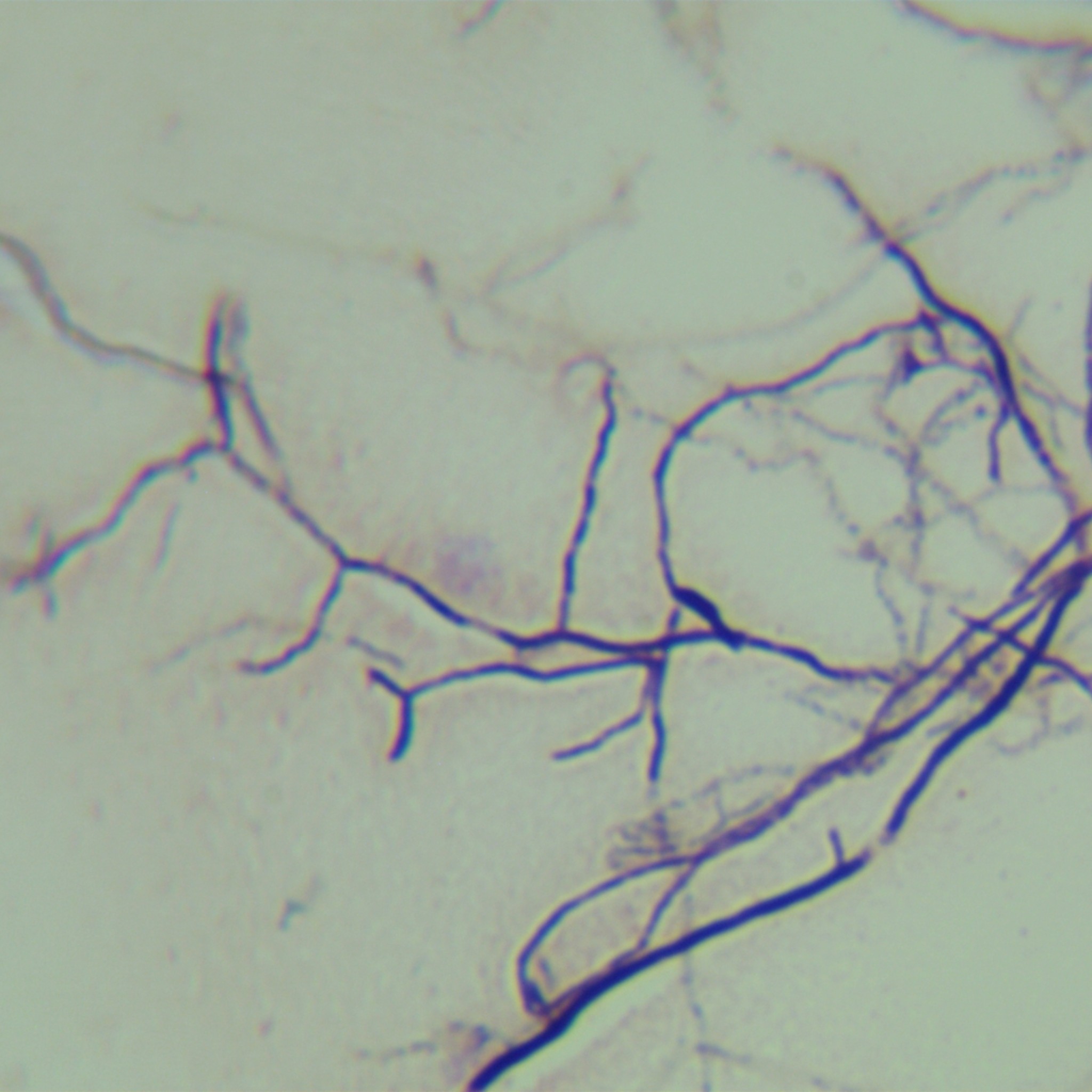Streptomyces bovis-BNCC