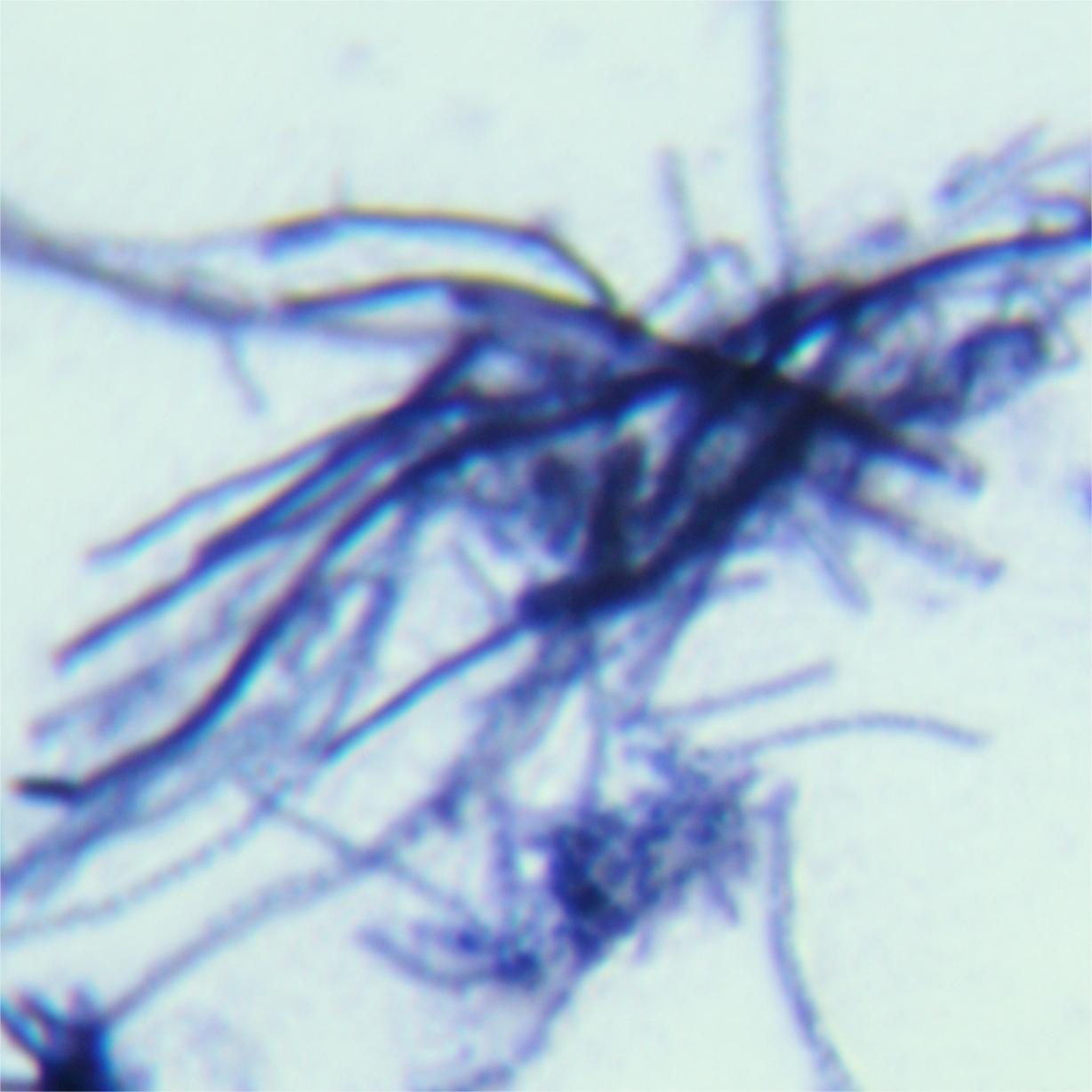 Spectacular Streptomyces-BNCC