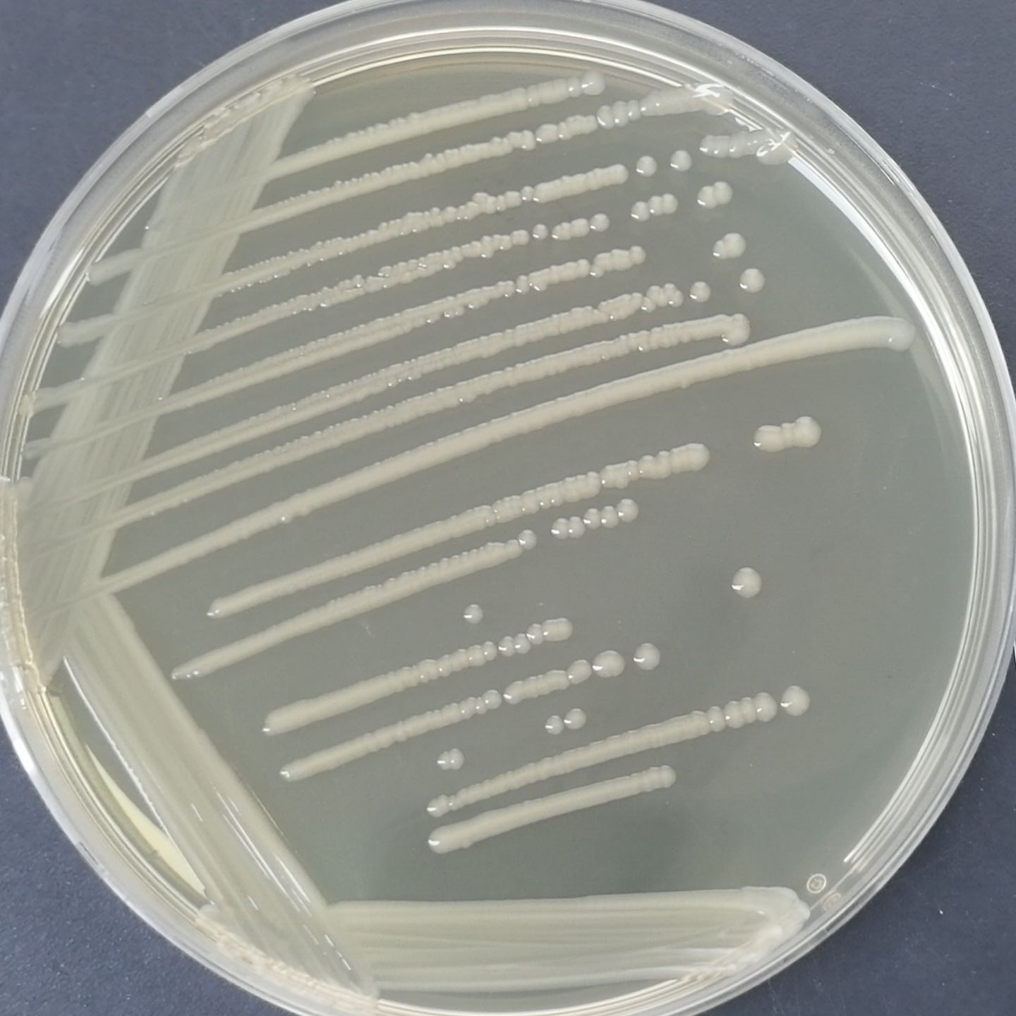 Fake Escherichia coli-BNCC