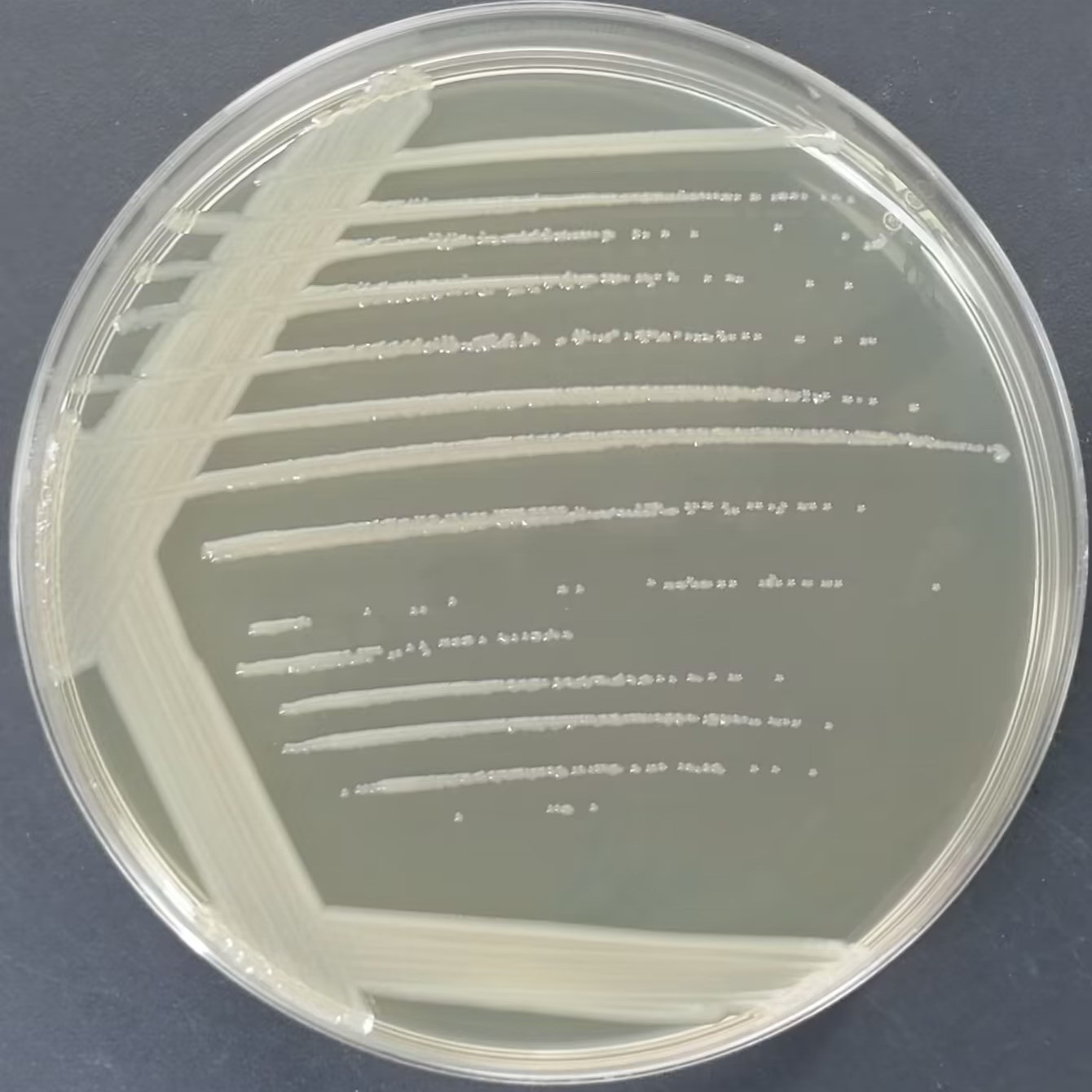 Rhizophilic oligotrophic bacteria-BNCC