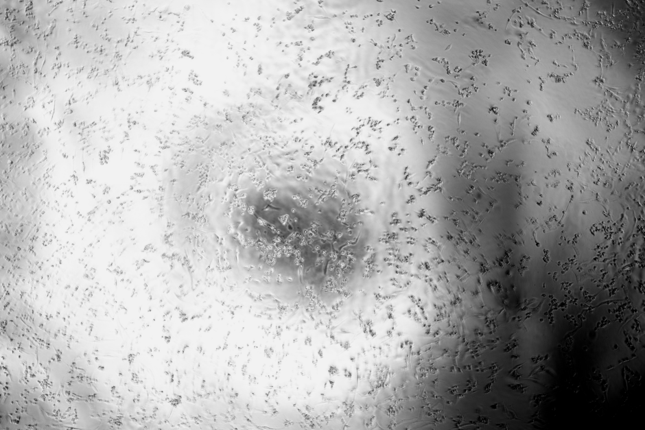Avian reovirus-BNCC