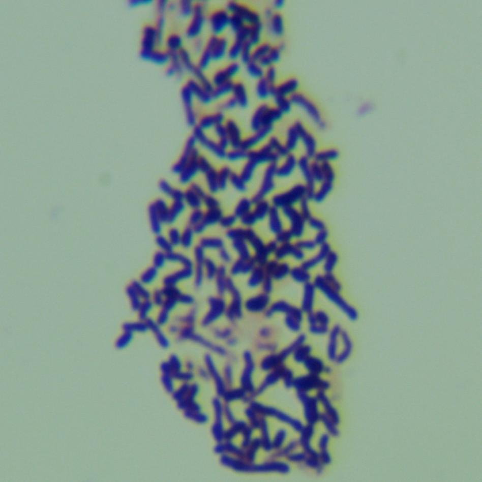 Bacillus subtilis-BNCC