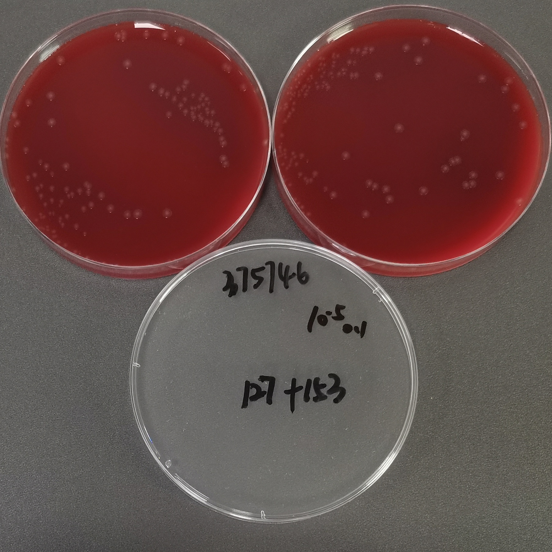 Neisseria gonorrhoeae-BNCC