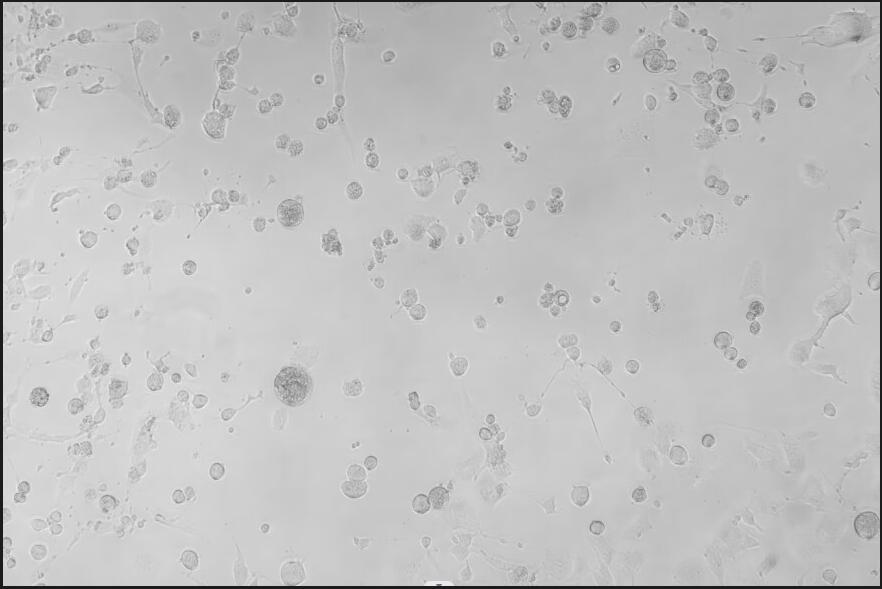Cowpox virus-BNCC