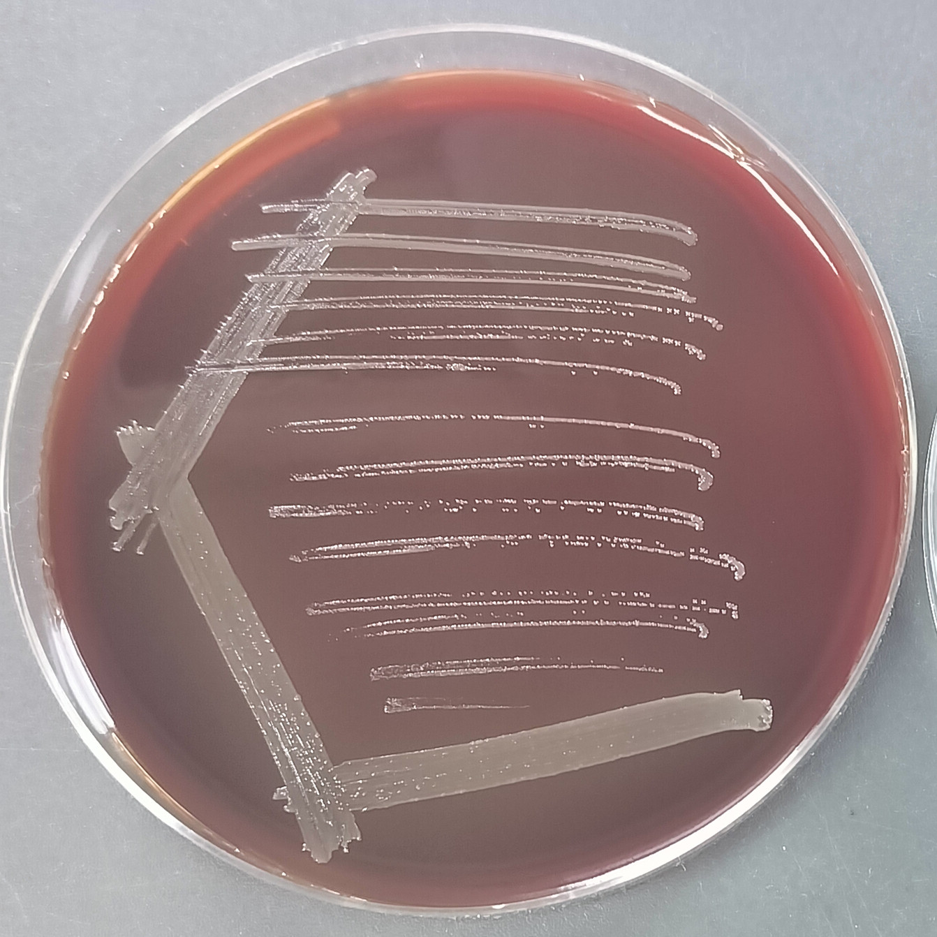 Bordetella pertussis-BNCC