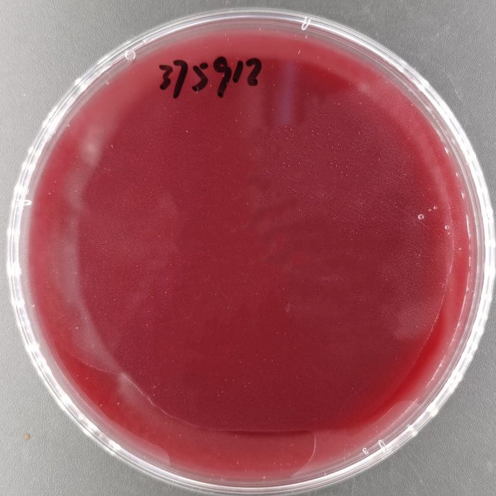 Bacillus subtilis-BNCC