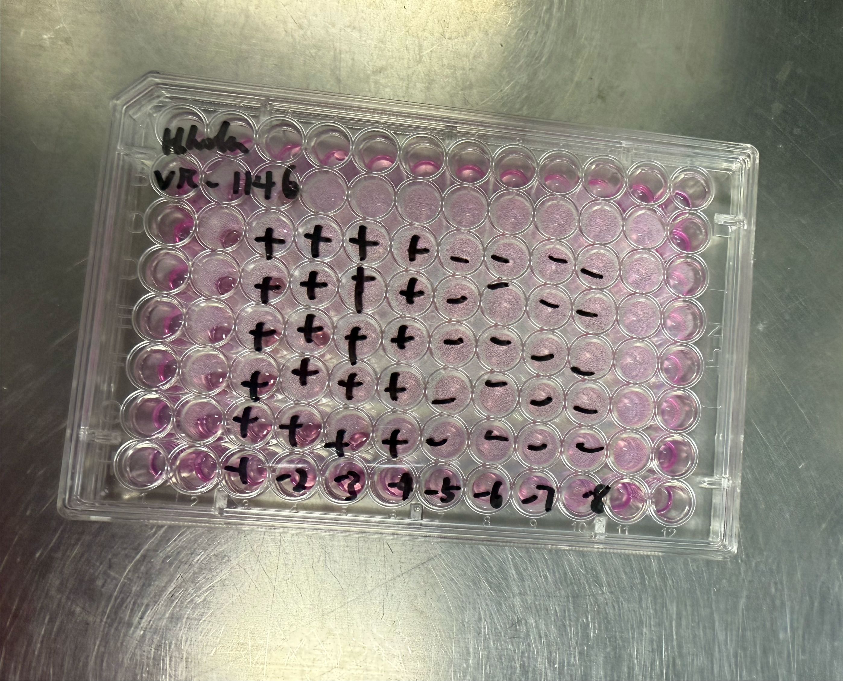 Human rhinovirus 36-BNCC