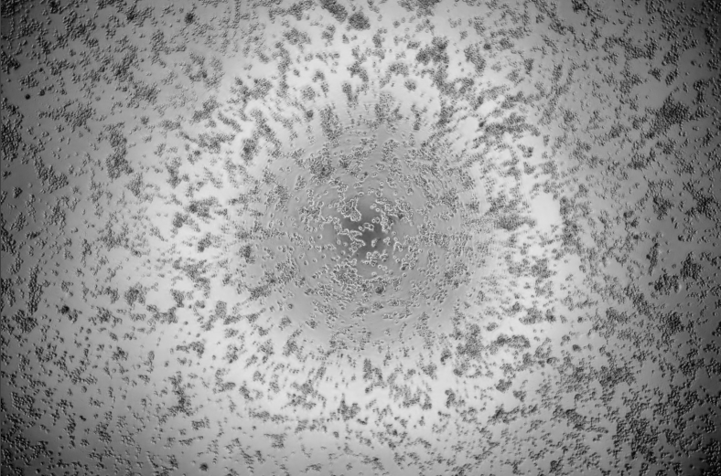 Human rhinovirus 36-BNCC