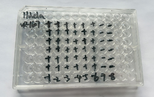 Human rhinovirus 37-BNCC