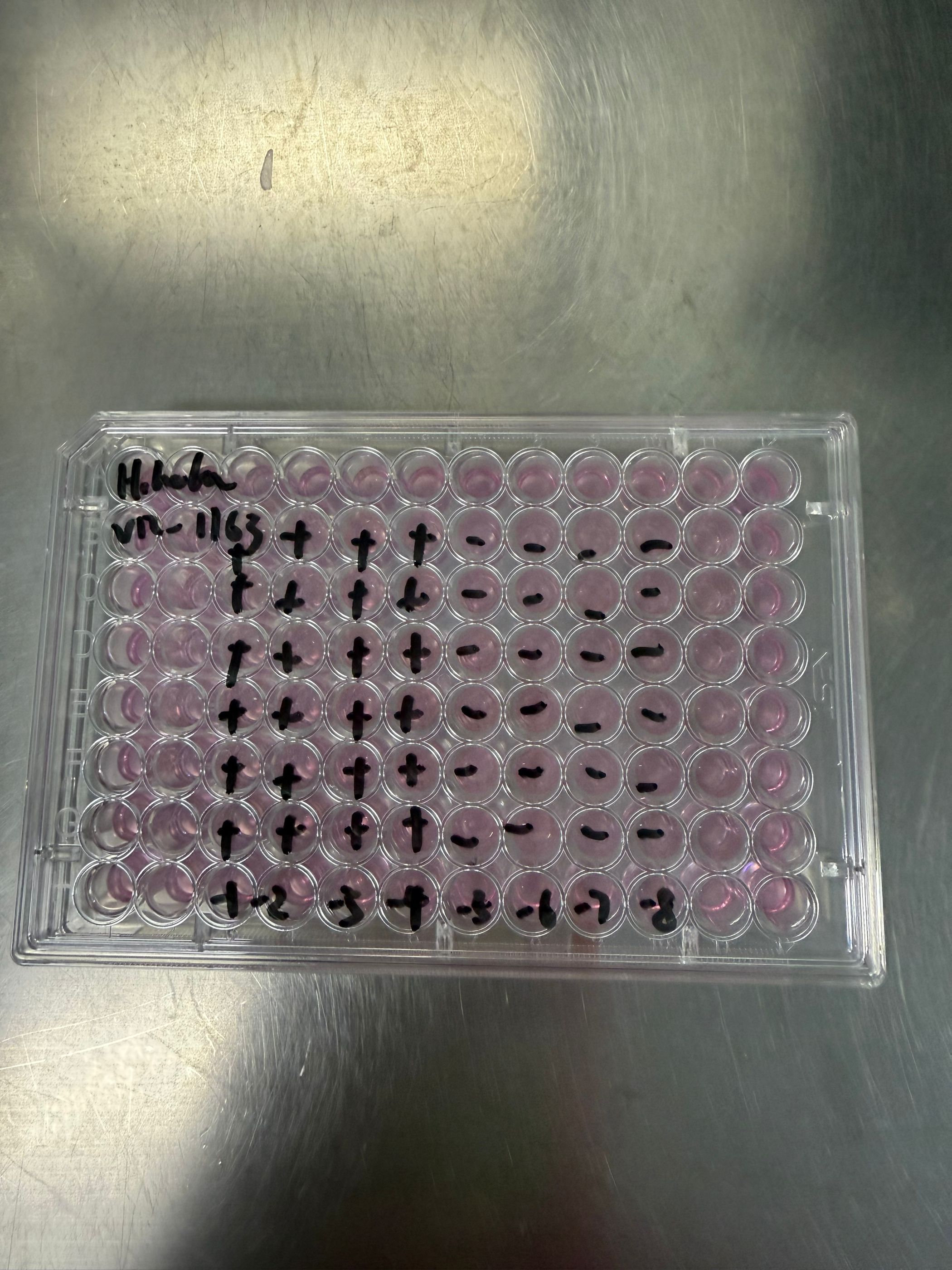 Human rhinovirus 53-BNCC