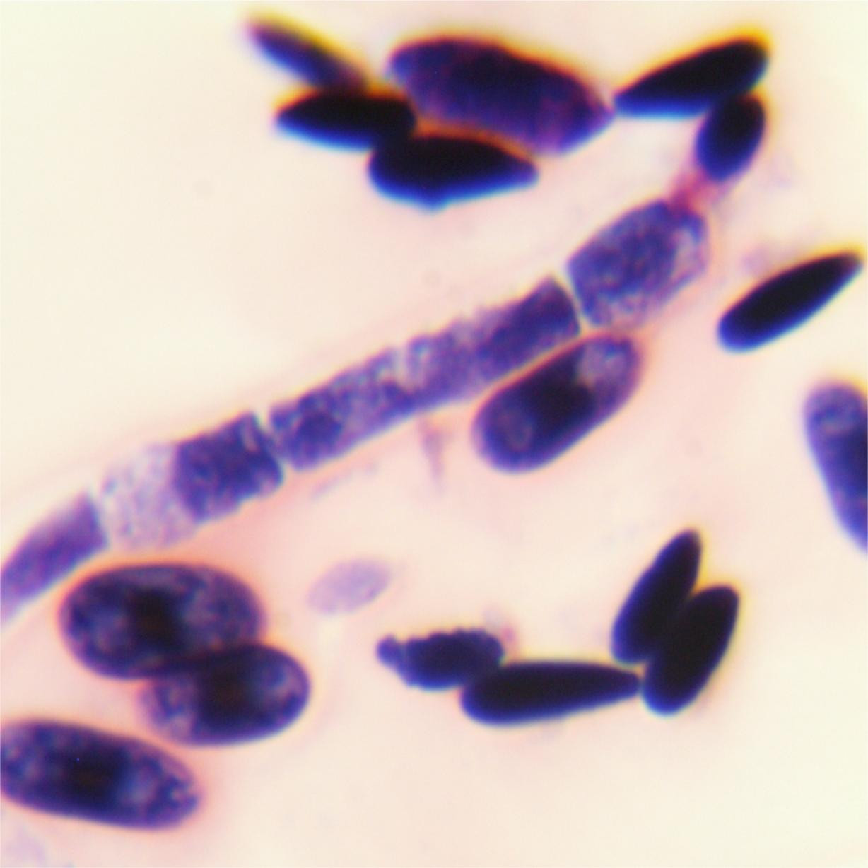 Budding short stem fungi-BNCC