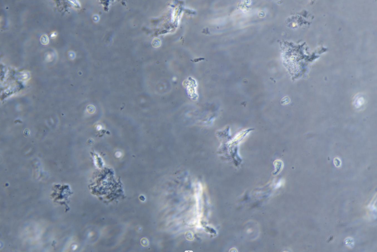 Trichomonas vaginalis-BNCC