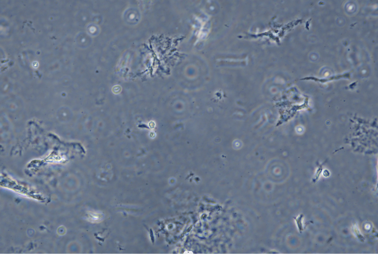 Trichomonas vaginalis-BNCC
