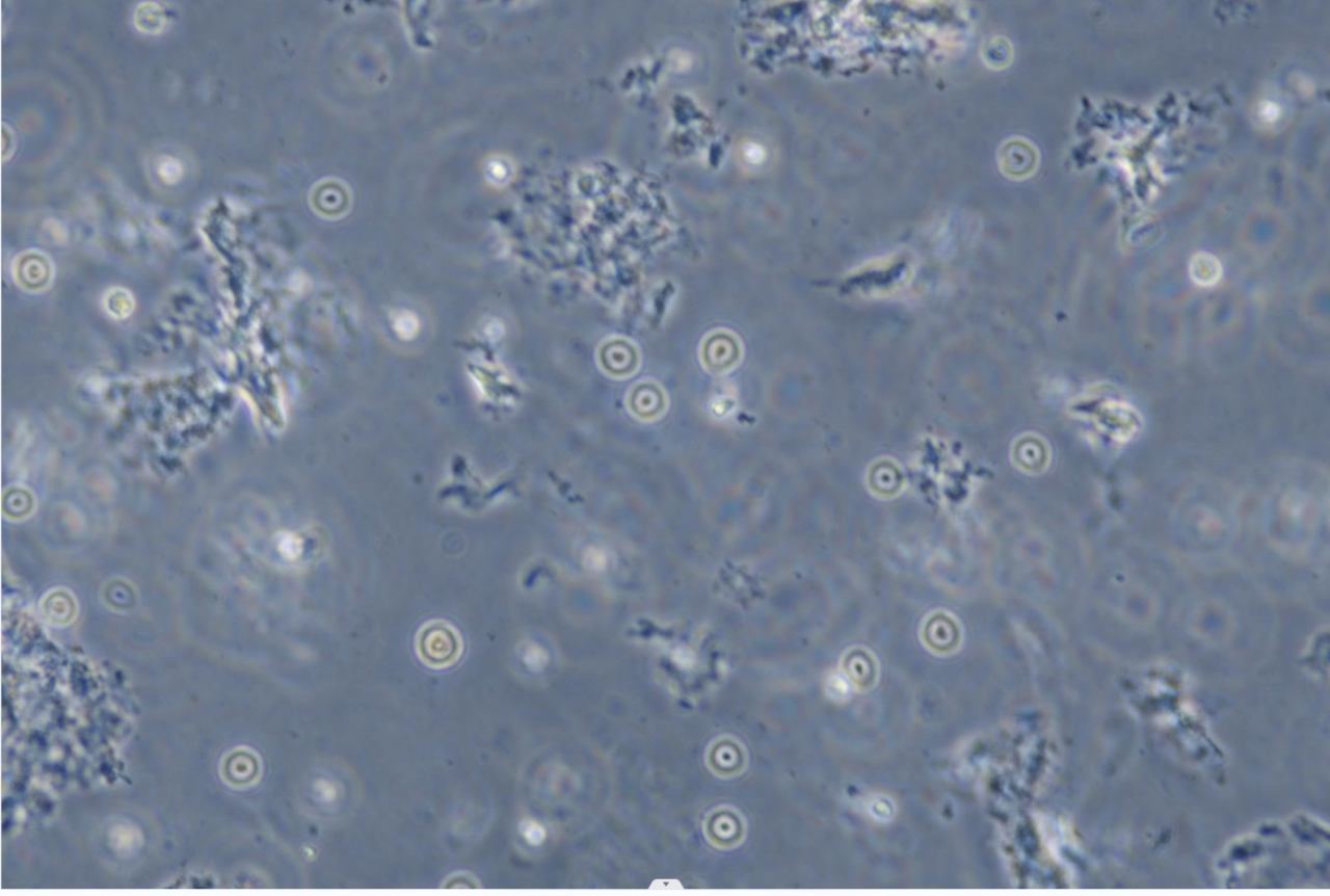 Trichomonas vaginalis-BNCC