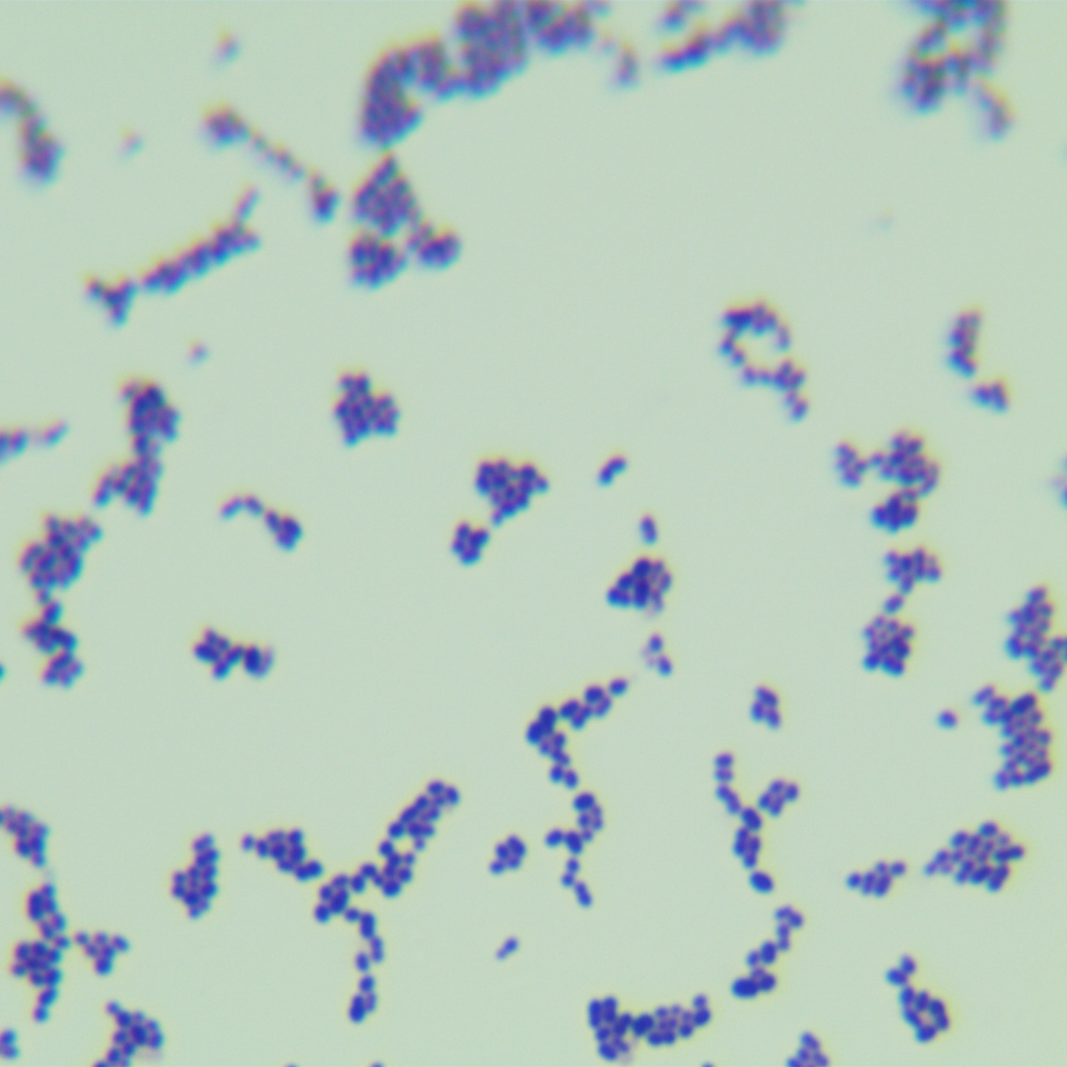 Streptococcal pharyngitis-BNCC